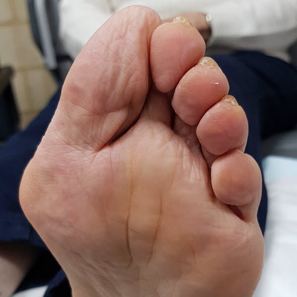 What is Toe? - Complete Guide