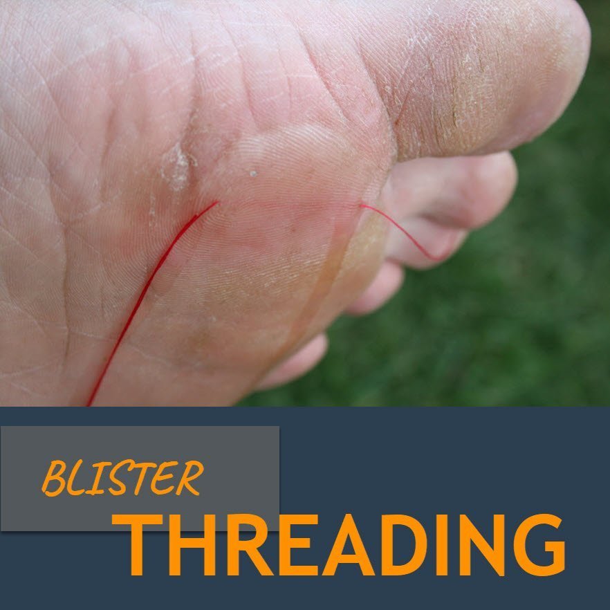 882-blister-threading-to-drain-a-blister