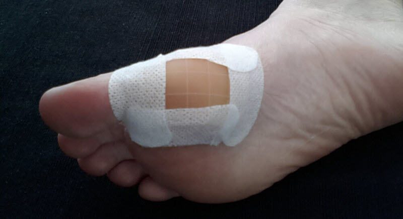 How To Use A Hydrocolloid Dressing Properly! - Blister Prevention -  Rebecca Rushton